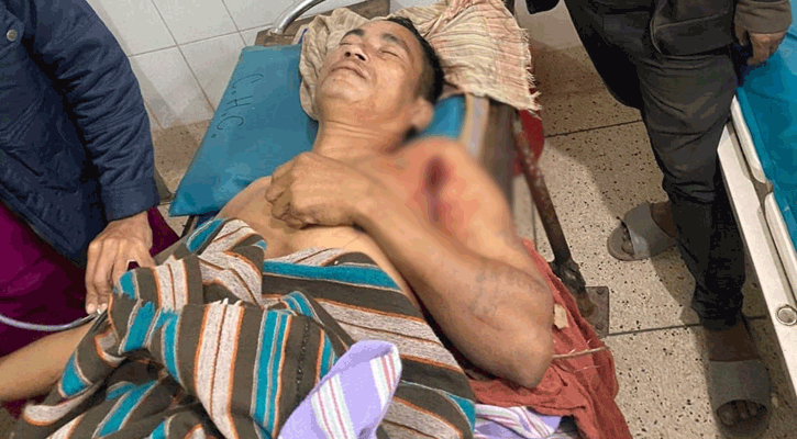 রাঙামাটিতে বন্যহাতির আক্রমণে যুবক আহত 